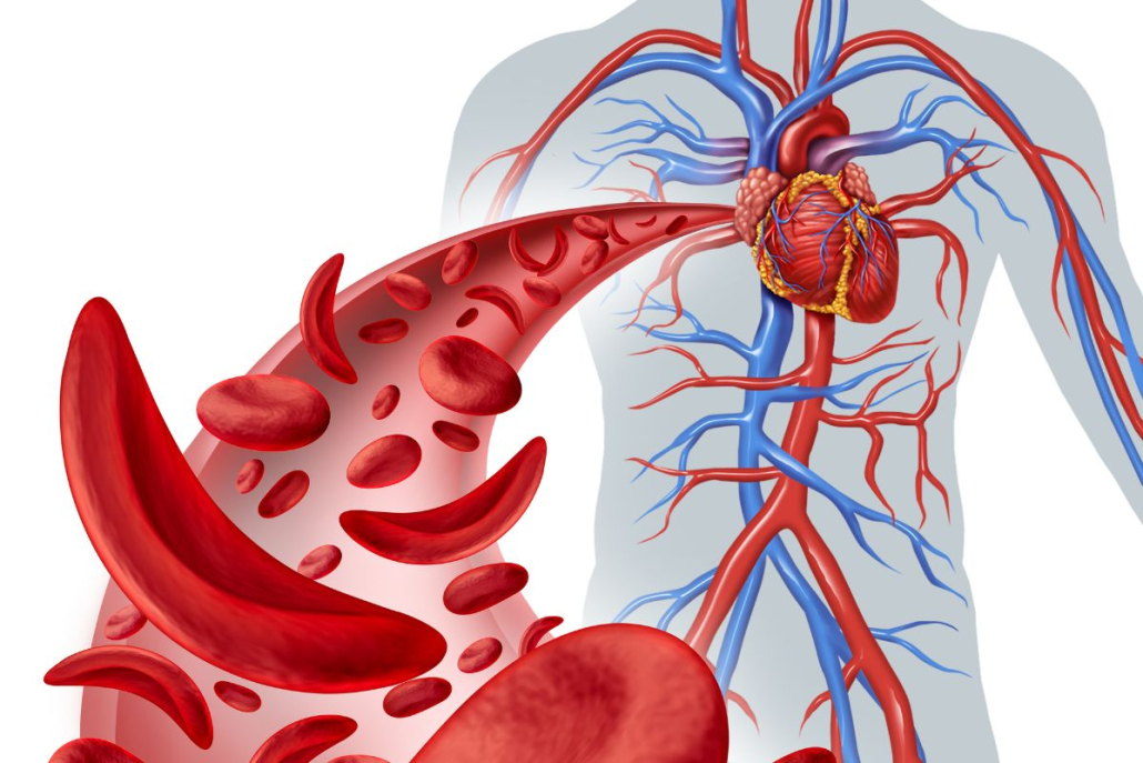 Anemia na doença renal crônica: por que o cansaço não é “normal”?